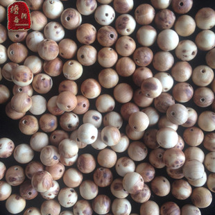 【星空app官网】宫颈炎不能等同于宫颈糜烂(图3) 星空app官方网页